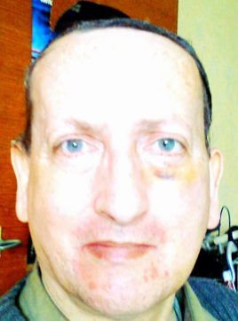 Bonk Gilles, 59 ans, Glenroy, Australie